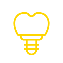 Implantes dentales | Dentistas en Palma de Mallorca